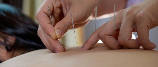 Healing Joint Pain Through Acupuncture: Know How It Works