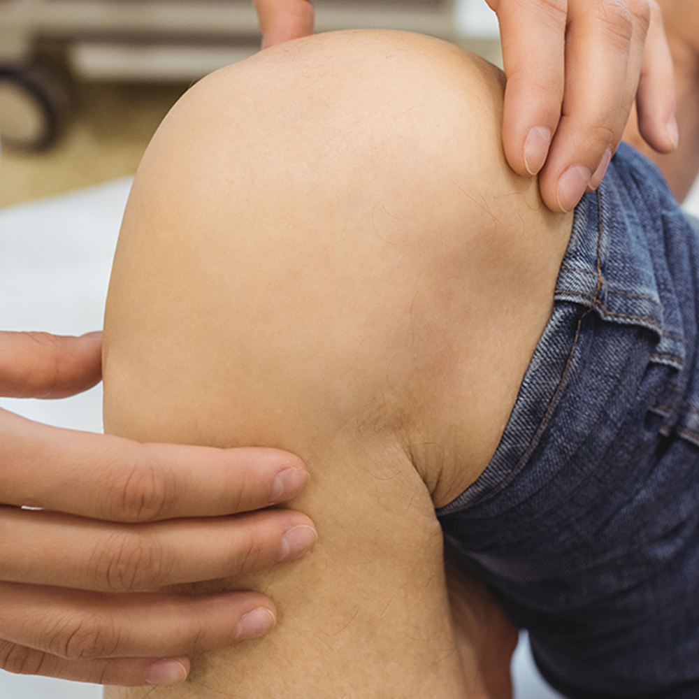 Osteoarthritis Surgery: Types, Recovery, Preventions